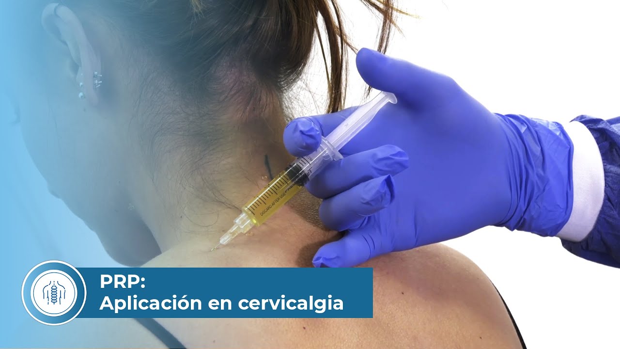 Plasma Rico en Plaquetas: Aplicación en cervicalgia