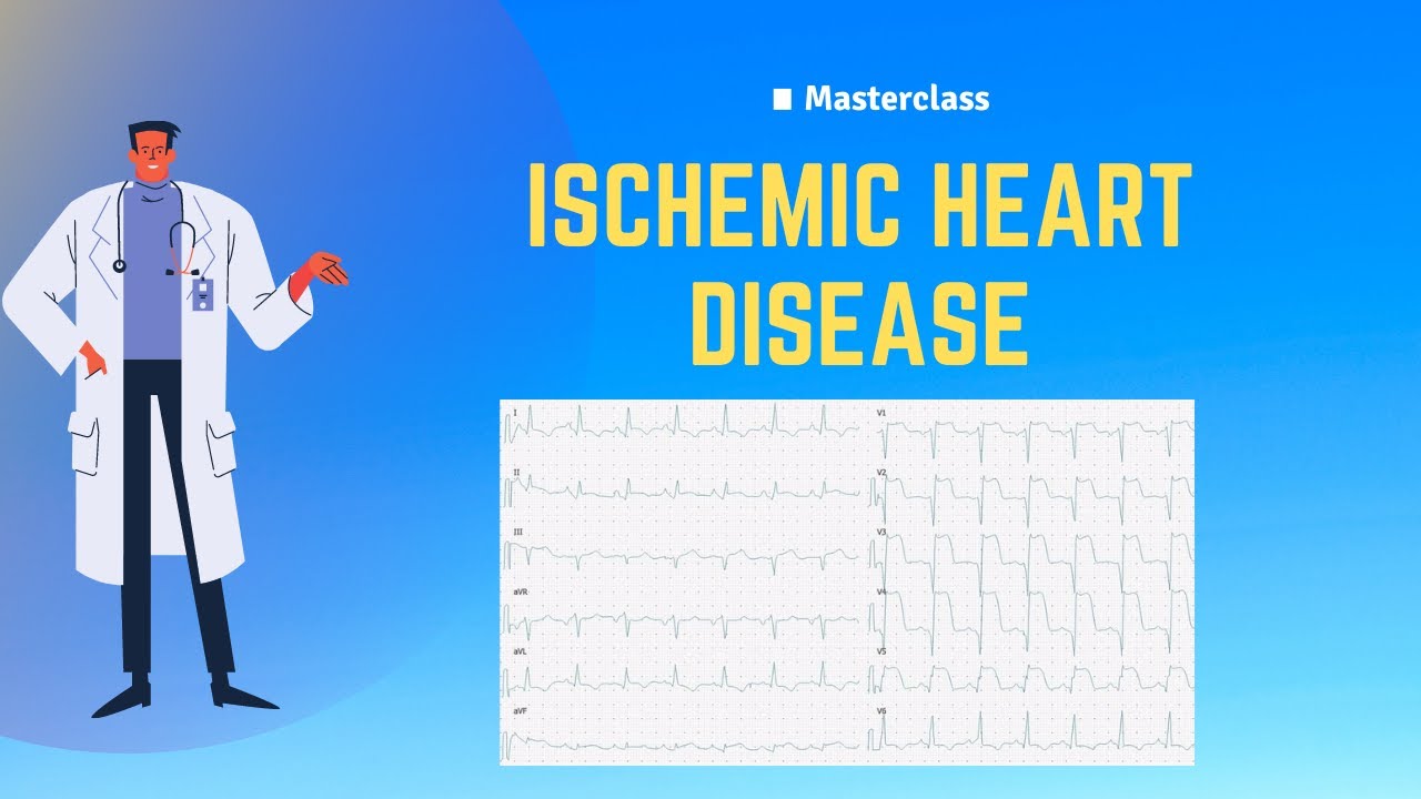 How to Read ECG in Ischemic heart disease