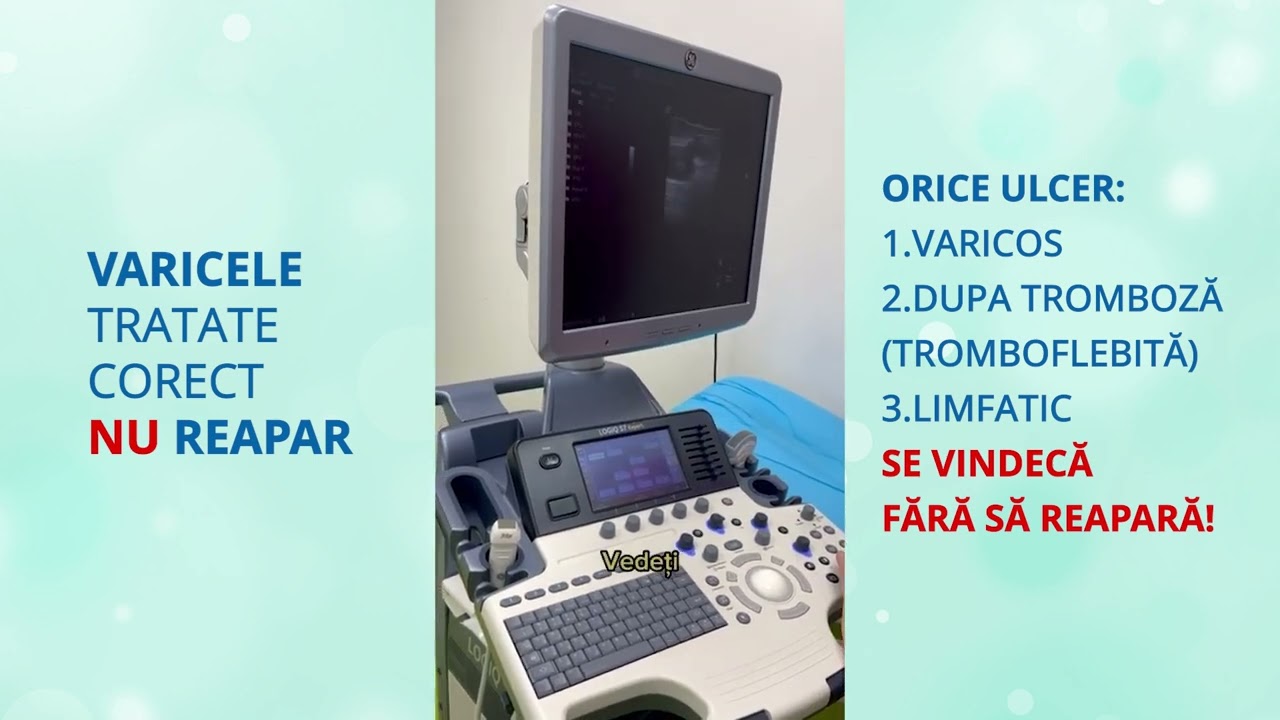 AMANAREA TRATAMENTULUI VA DUCE LA VARICE DIN CE IN CE MAI MARI CU RISCUL DE APARITIE A COMPLICATIILO