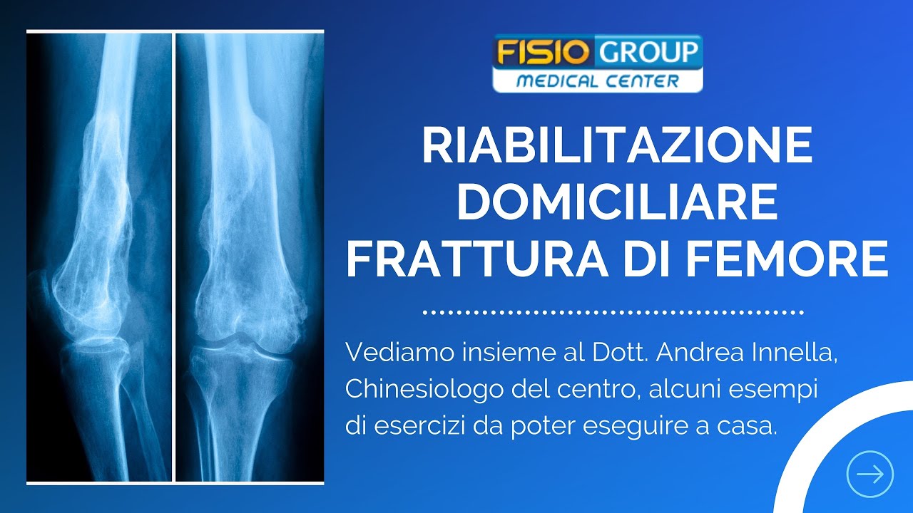RIABILITAZIONE FRATTURA FEMORE - ESERCIZI A CASA
