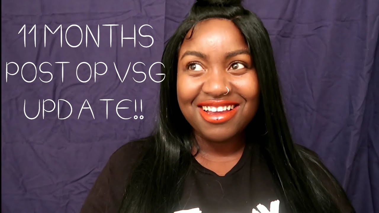 11 MONTHS POST OP VSG UPDATE| 170lbs lost! Vitamins, weight loss, struggles, food