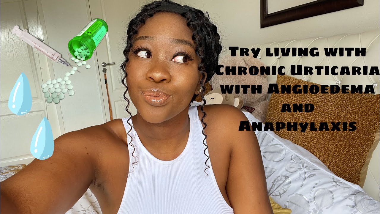Living with Chronic Urticaria with Angioedema and Anaphylaxis