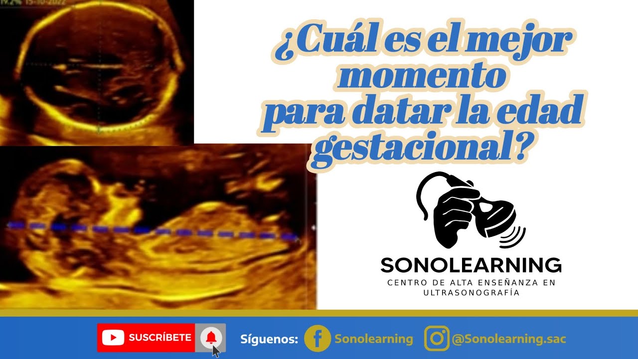 DATACION DE LA EDAD GESTACIONAL