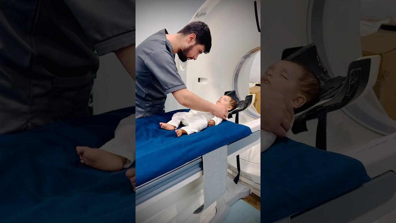 High-Resolution CT Scan of Temporal Bone for Cochlear Implants in Kids:Sedation & Recovery Explained