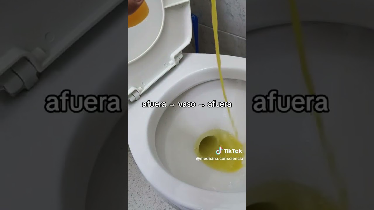 ¿Cómo recolectar muestra de orina? 