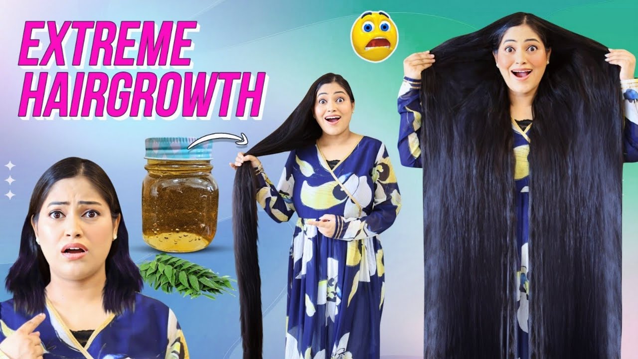 Most Powerful Diy to Stop Hairfall, Get Triple Hairgrowth for Rs0😱 गंजे सर पर बाल उगाने का आसानतरीका