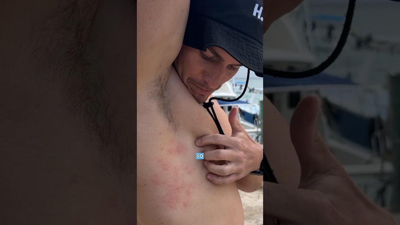 STUNG by a jellyfish while diving a shipwreck 🪼