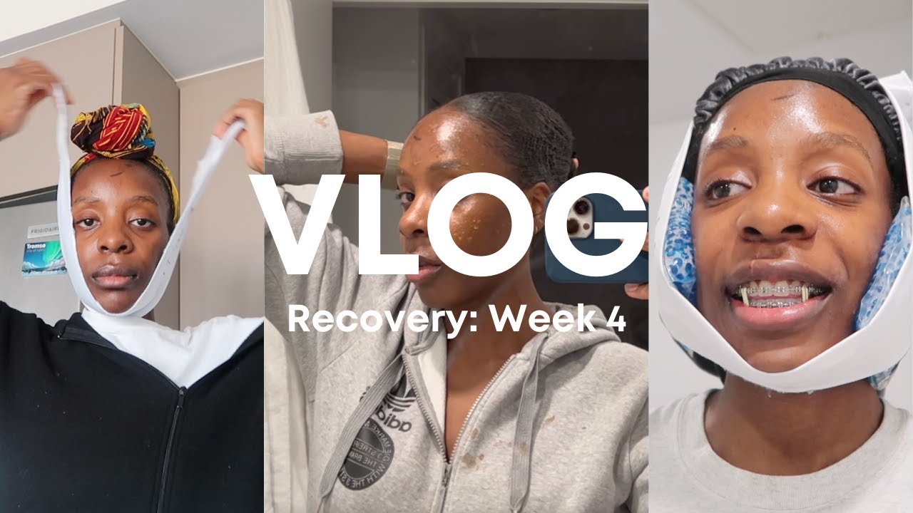 VLOG #16: Weeks 4 After Double Jaw Surgery - Heat Compress, Nerve Regeneration, and Popsicle Sticks