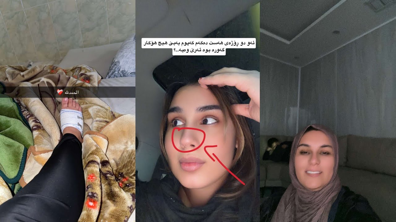 خەندە قاچی بریندار بوو😳مێلۆک دەگریی👶