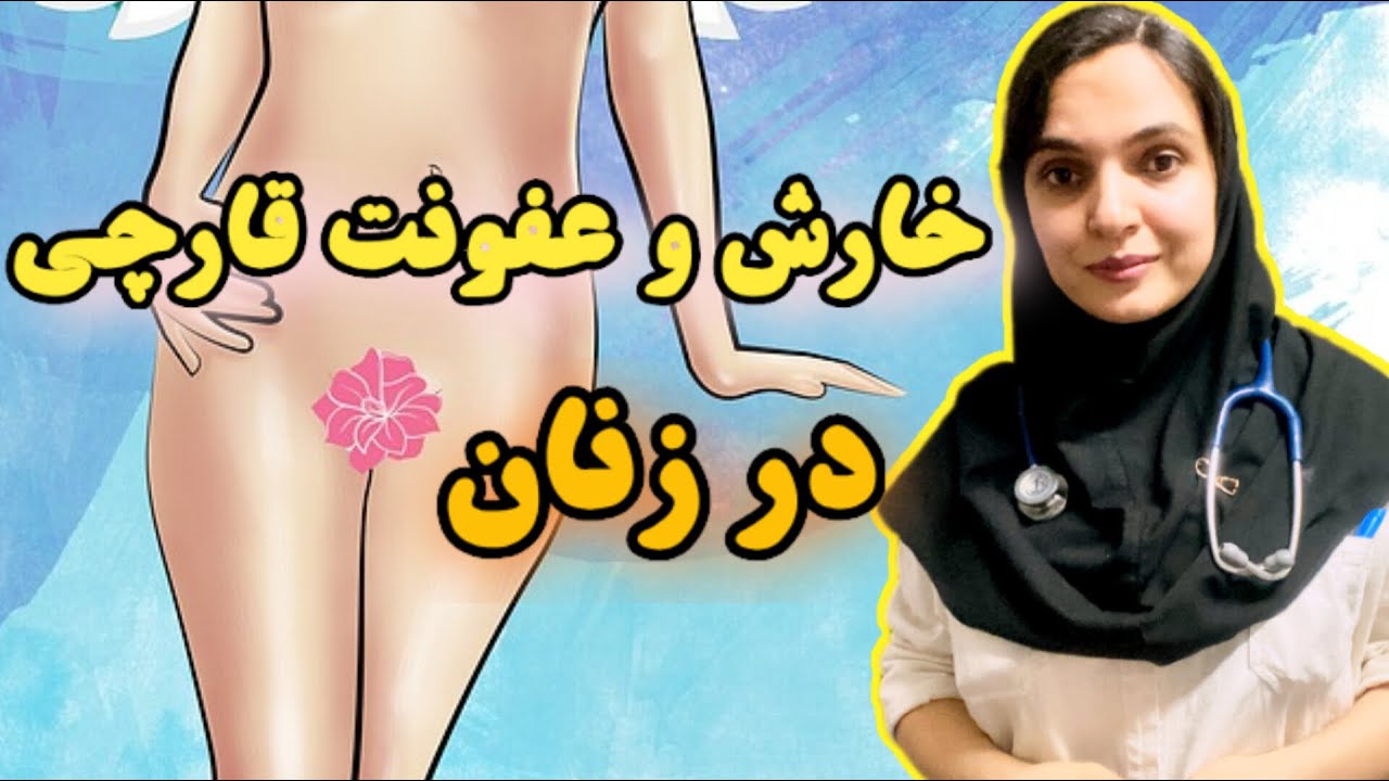 خارش و عفونت قارچی زنان « بهداشت بانوان » نکاتی که باید یادمون میدادن