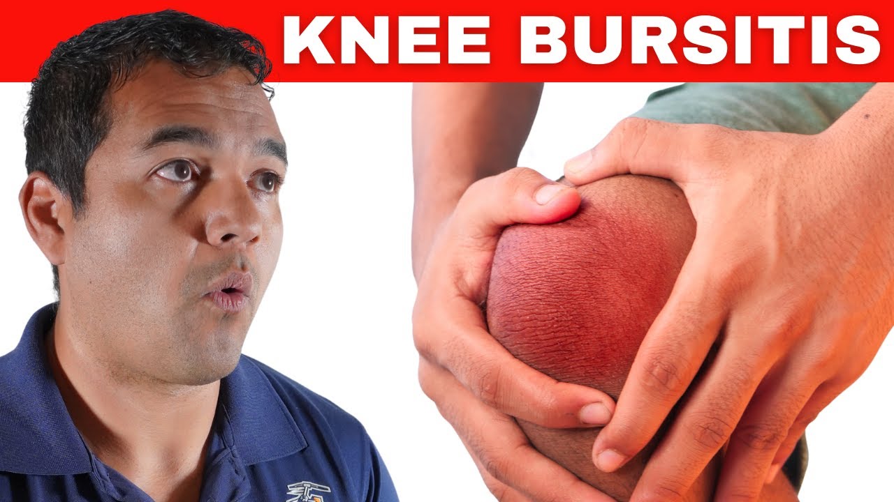 Healing Knee Bursitis: Top 5 Treatments for Rapid Healing