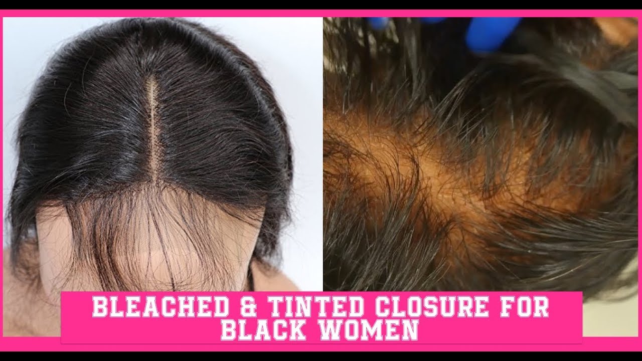 WHAT CLOSURE ?! Bleached Knots & Tint Lace W. Black Tea Bags