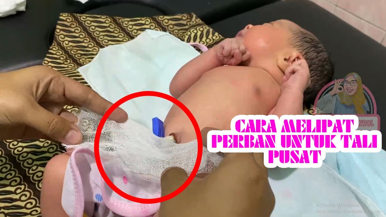 Cara Mudah Memasang dan Merawat Tali Pusat