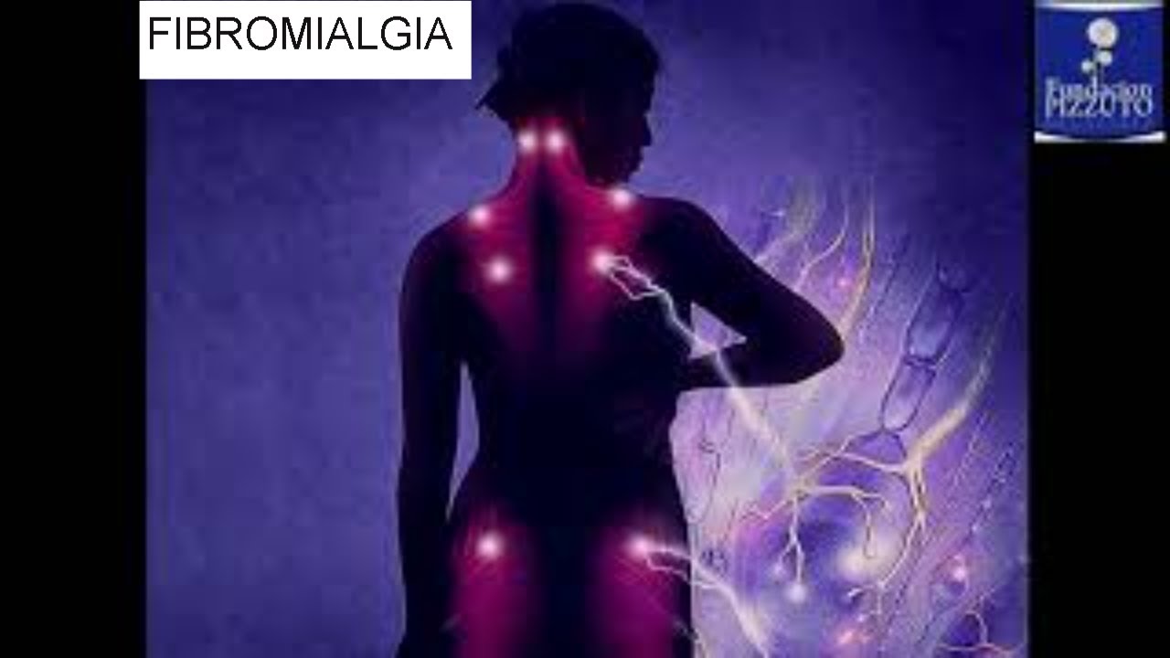 FIBROMIALGIA ¿Qué es y como tratarla? (2021) / DR. ALEJANDRO DANGELO