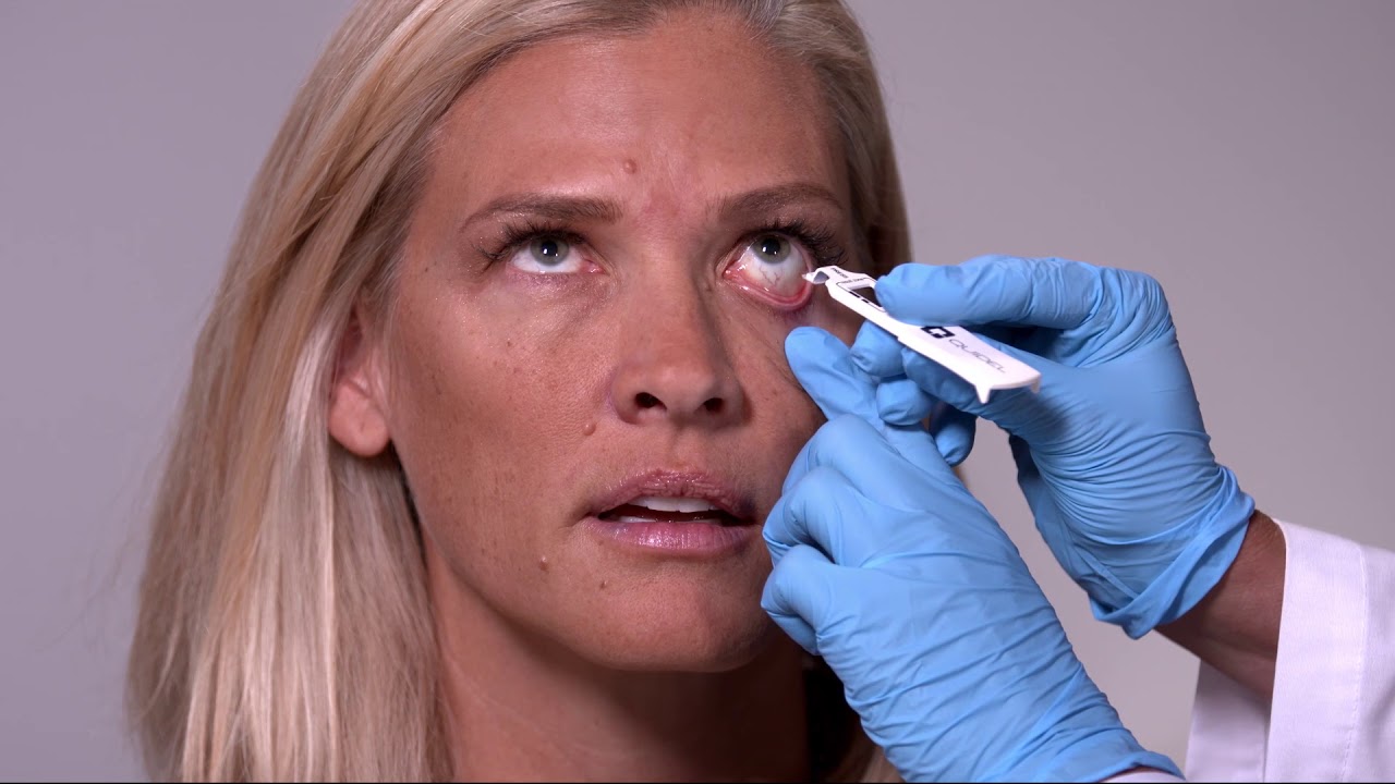 Quidel InflammaDry Product Training Video