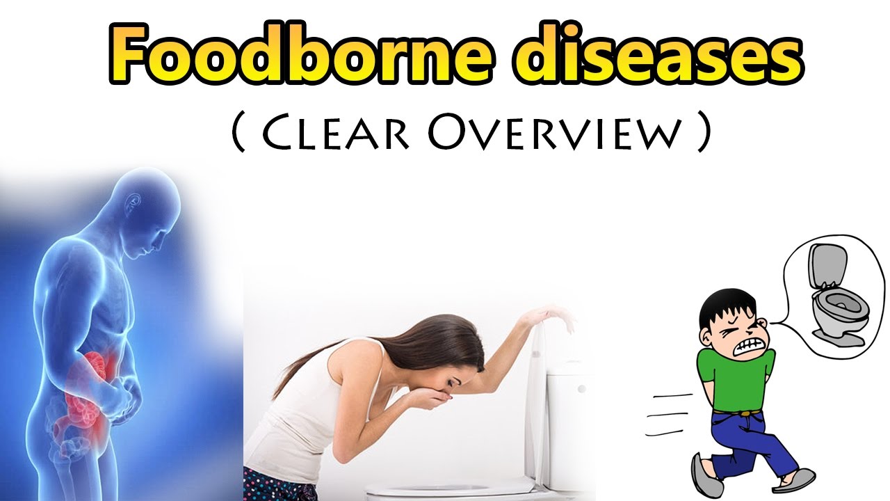 Food Borne diseases ( Clear Overview )