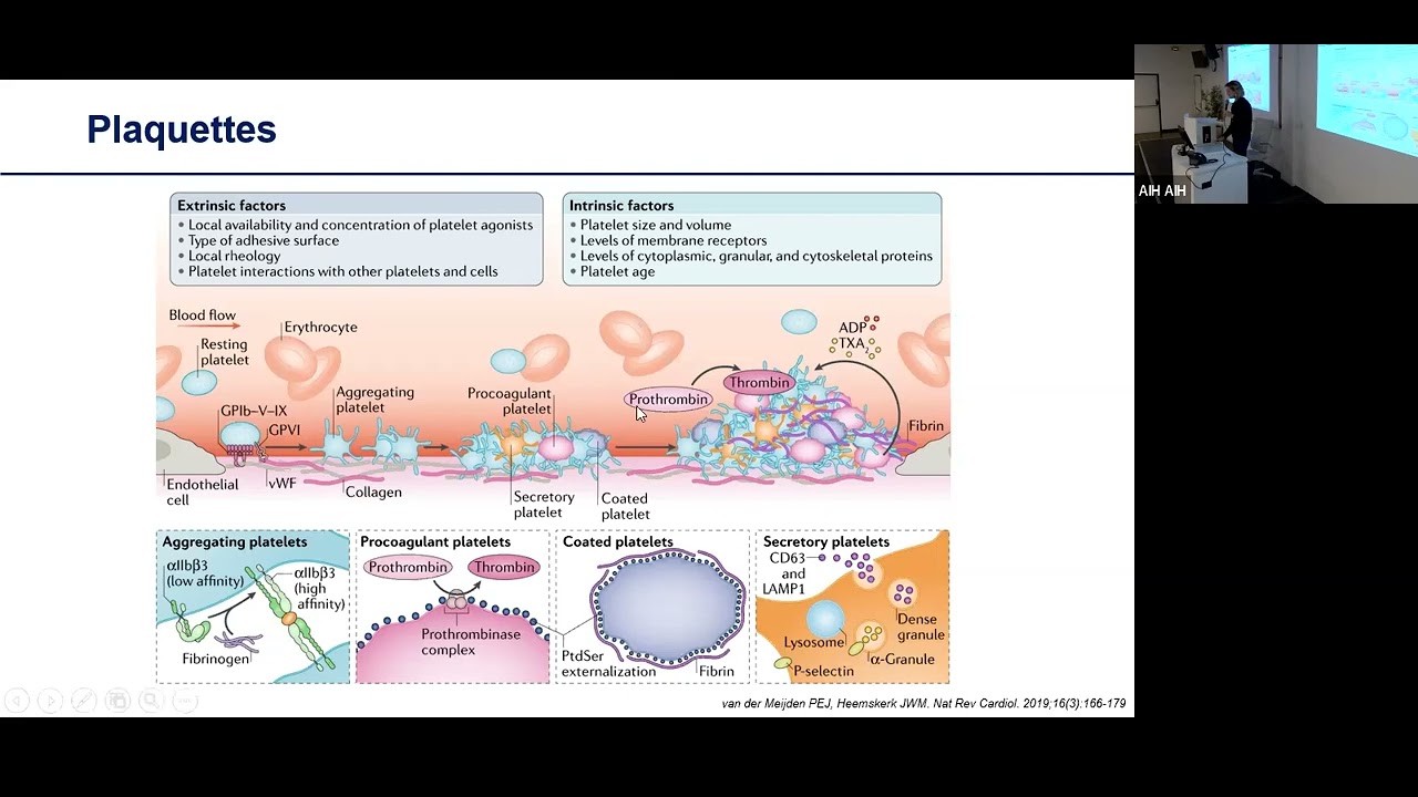 DES hémostase : syndromes hémorragiques