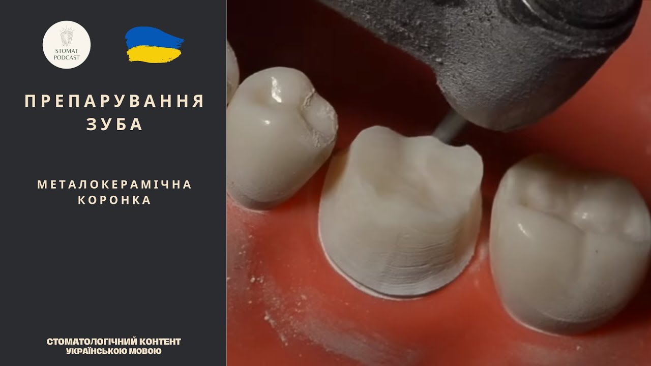 Препарування зуба під металокерамічну коронку