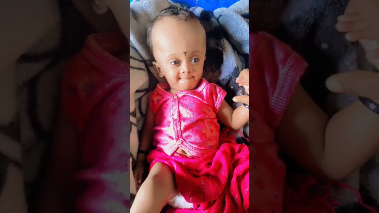 #cutebaby#prematurebaby#anvi#hydrocephalus#playing😘😘😘😍😍😍😍🥰🥰🥰🥰🥰😍😍😘😘😘😘🥰🥰🥰🥰