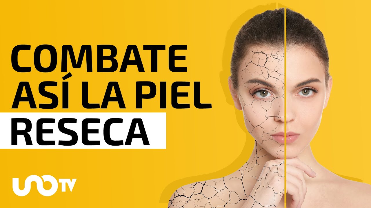 Remedios caseros para aliviar la piel seca causada por el clima fr&iacute;o