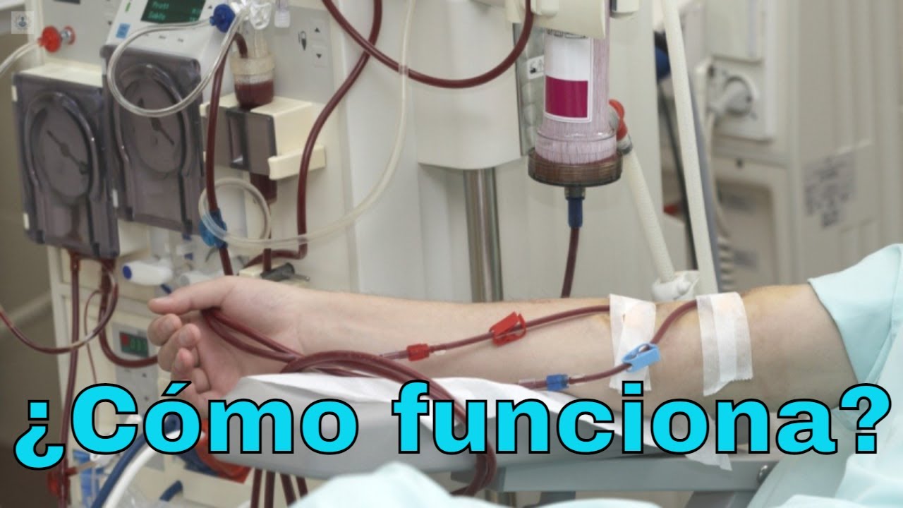 ¿Qué es la hemodiálisis?