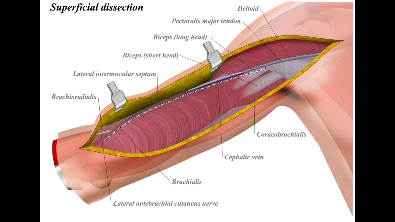 Brachial Artery