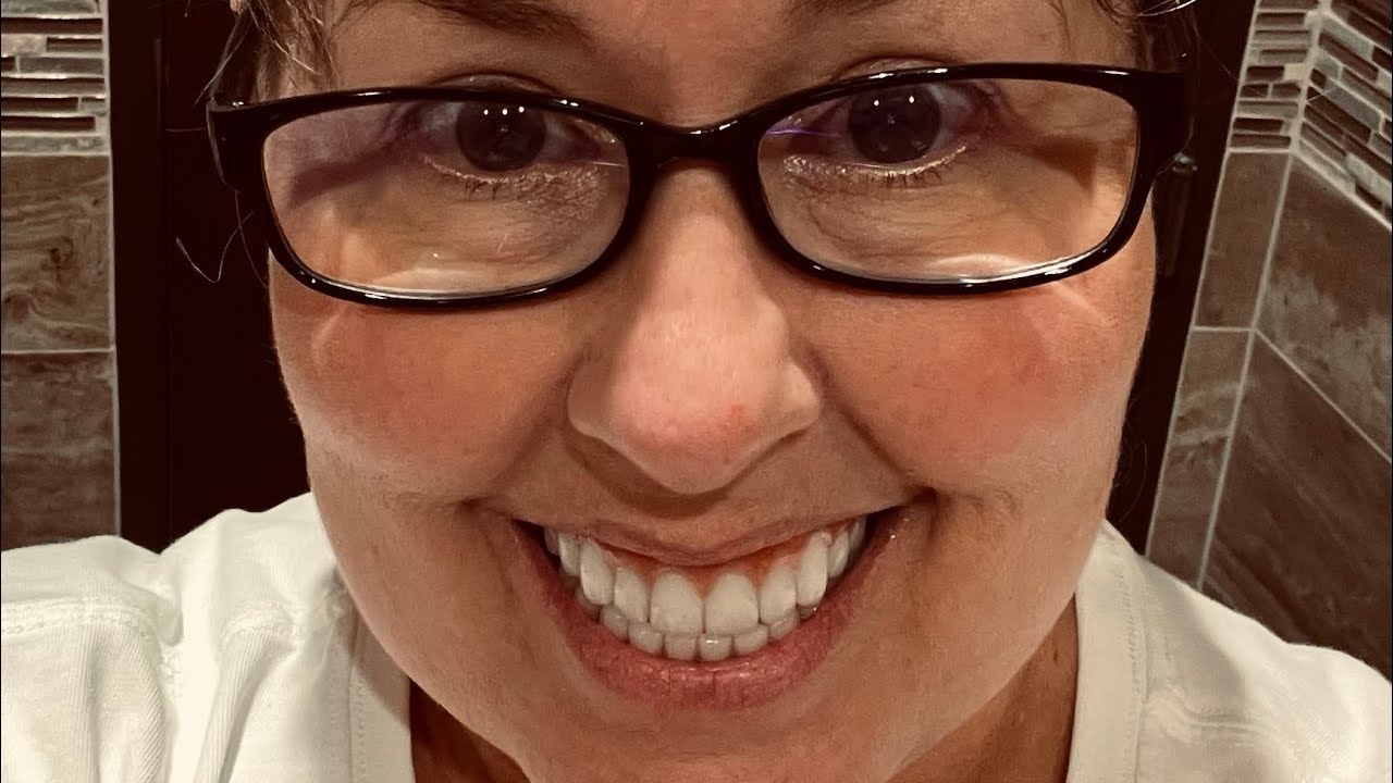 Dry mouth, shingles and annoying blinkers.