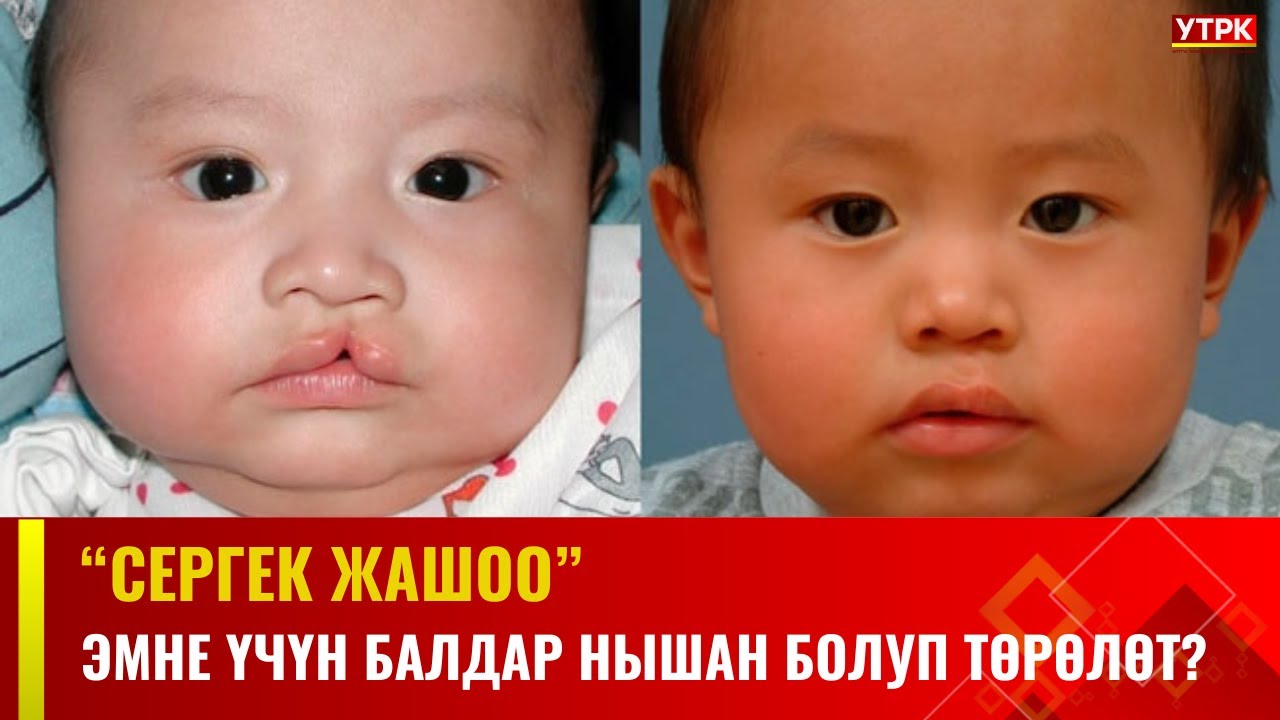 Эмне үчүн балдар нышан болуп төрөлөт? | СЕРГЕК ЖАШОО