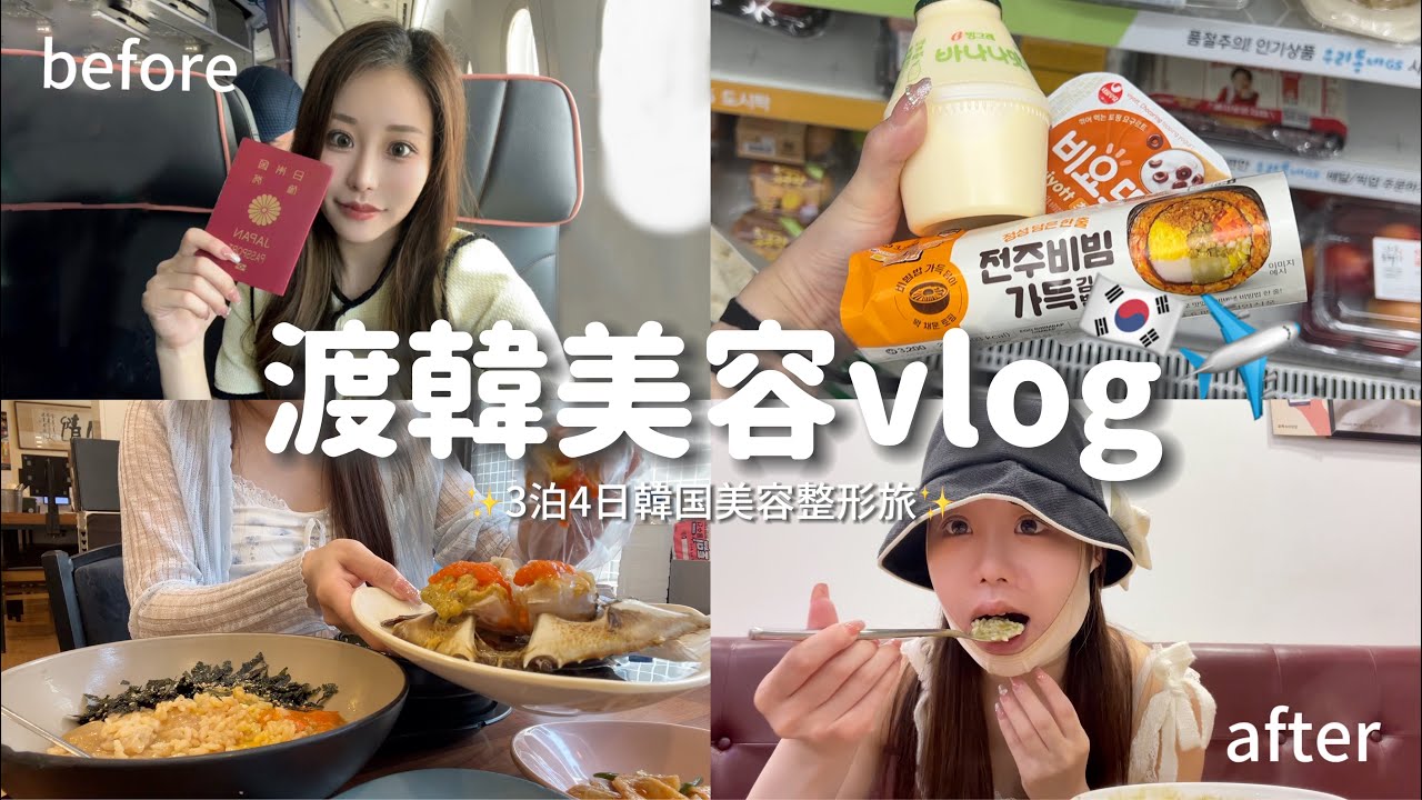 【美容vlog】韓国美容旅🇰🇷✈️輪郭脂肪吸引してきた✨|美容整形|輪郭整形|渡韓美容|カンジャンケジャン|聖水駅|明洞|カロスキル|ショッピング|女子旅|韓国グルメ|ソウルグルメ|ソウル|
