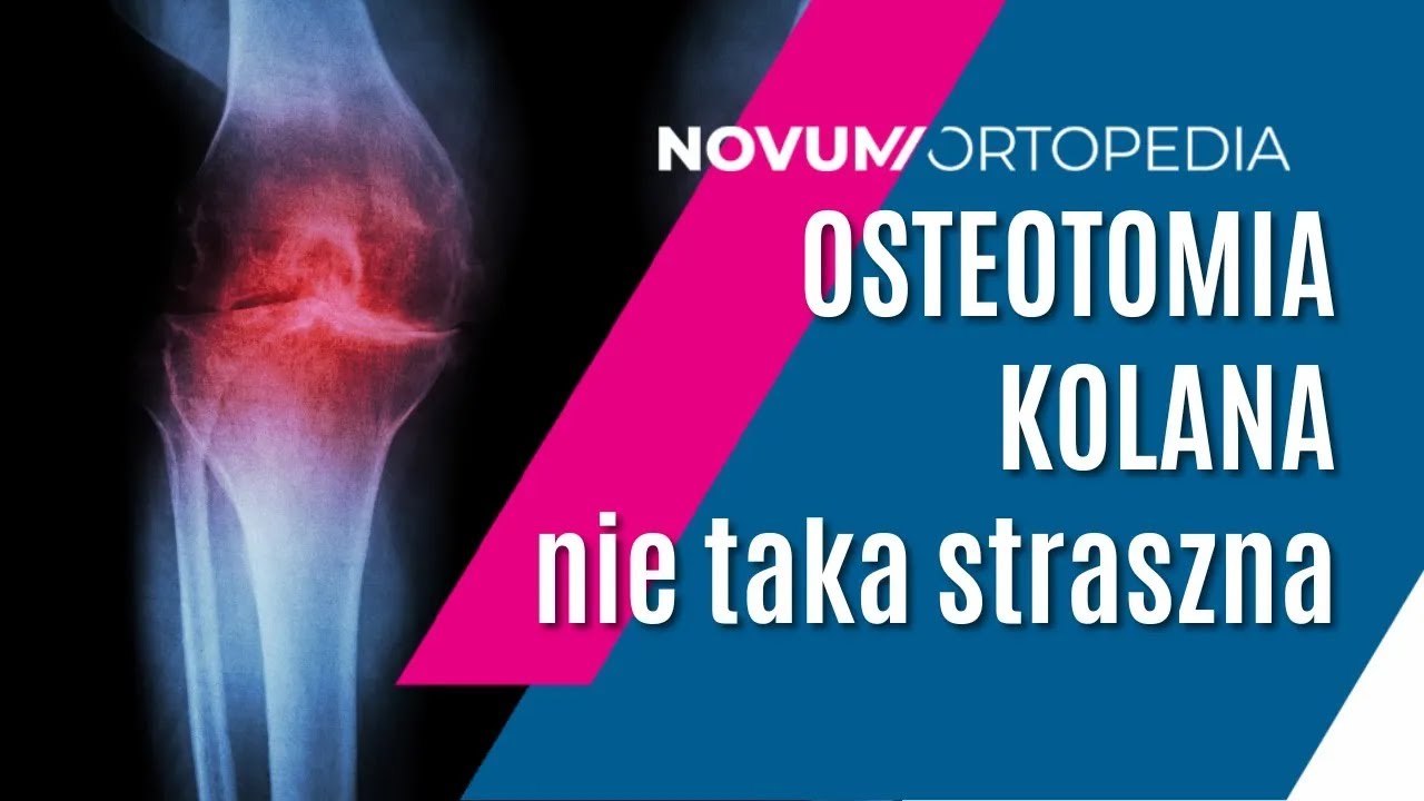 OSTEOTOMIA kolana - na czym polega ZABIEG? | Novum Ortopedia