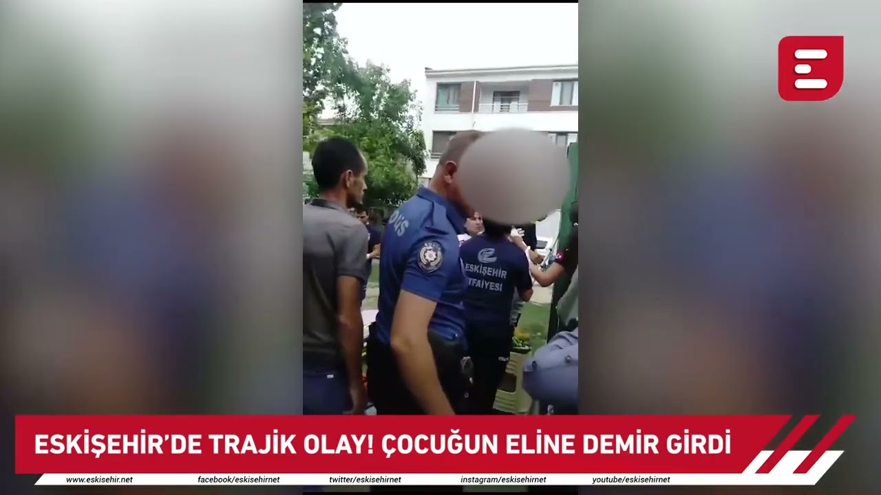 Eskişehir'de trajik olay! &Ccedil;ocuğun eline demir girdi!
