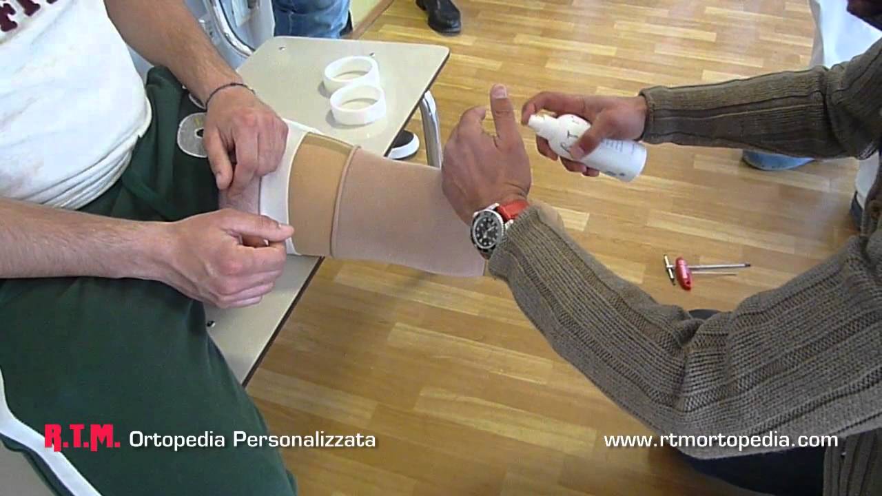 RTM Ortopedia: Anteprima del piede Flex Run™ Ossur con cover Nike