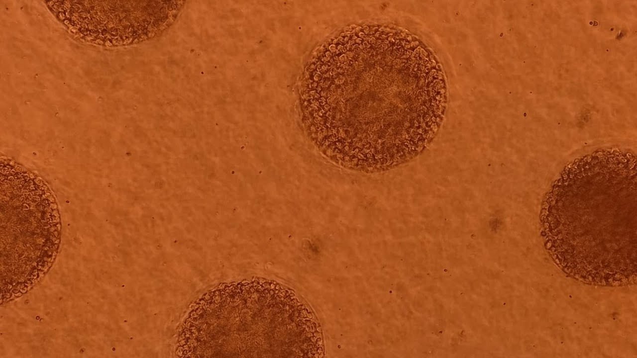 Cultivo 3D - Esferoides