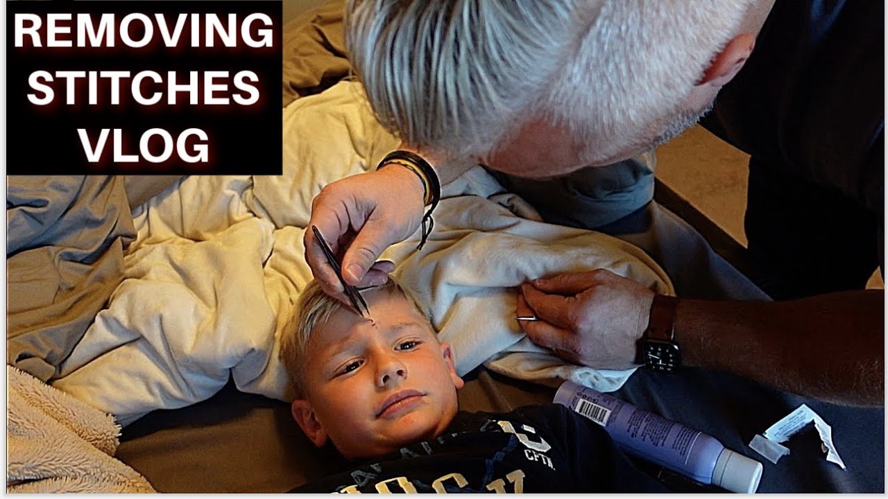 REMOVING STITCHES | COSTCO TRIP & GIFTS |