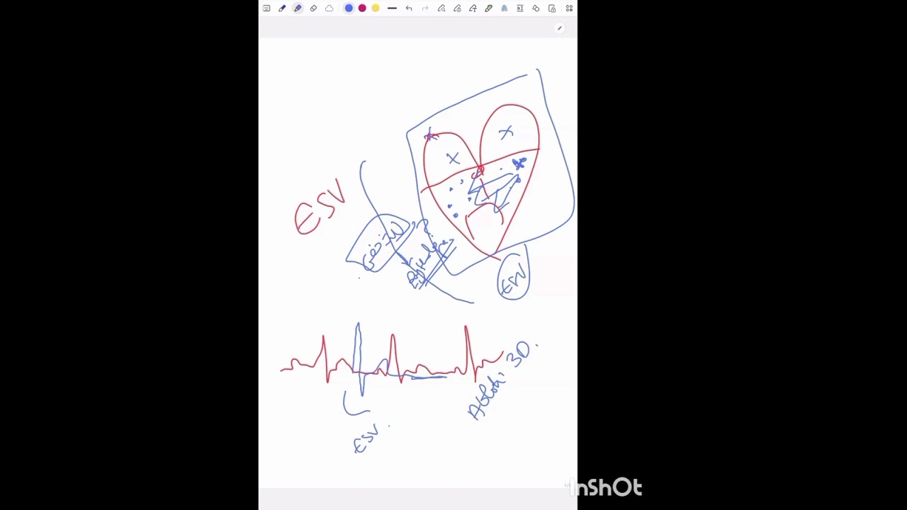 دقائق قليلة لتعلم الاوسيجي ❤️‍🩹🩷 للتحصل عليها مسجلة راسلونا عبر الواتسب0799234320
