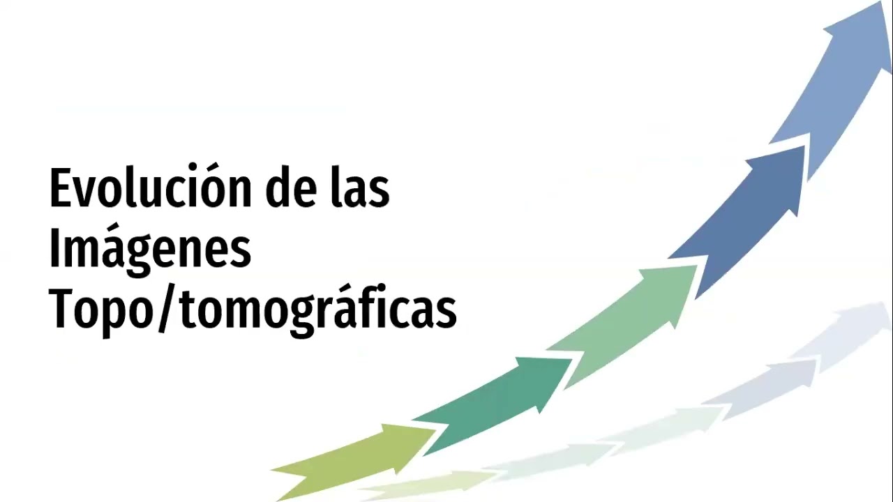 Principios de normalidad Tomografía Corneal ‐ Dr. Juan David Celades