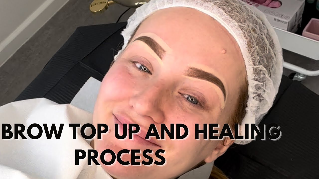 BROW TOP UP AND HEALING PROCESS