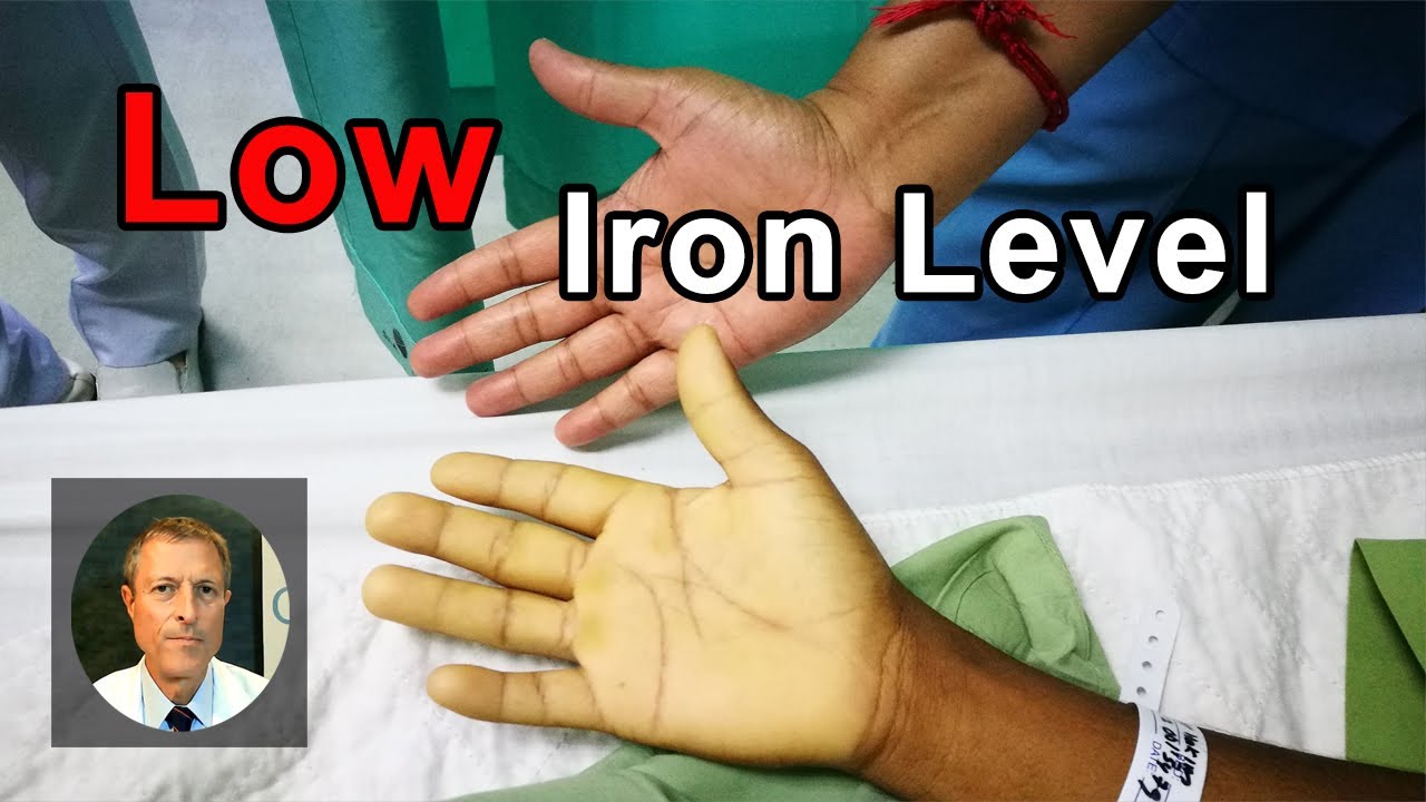 Why Am I Having A Low Iron Level? -  Neal Barnard, MD