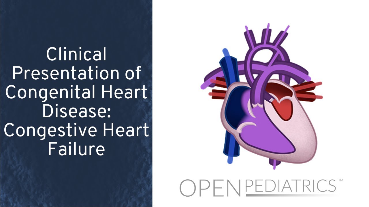 Congestive Heart Failure by M. Freed, I. Baiu, L. DelSignore | OPENPediatrics