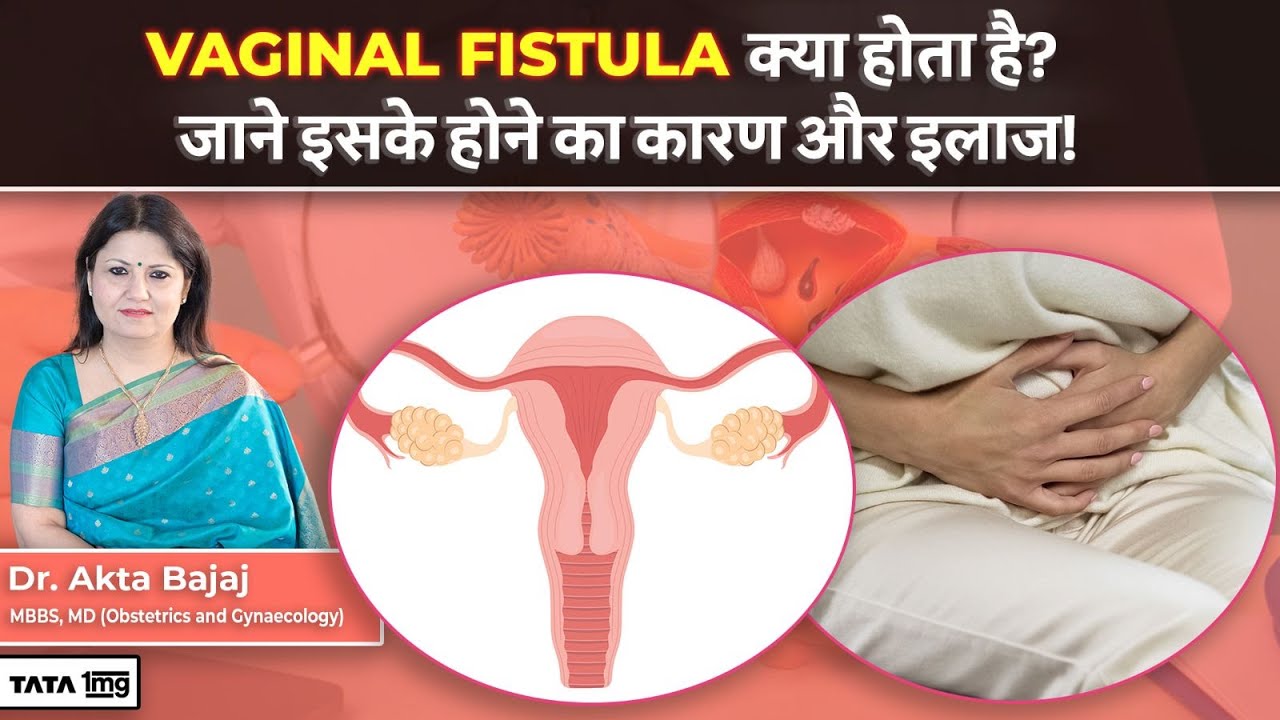 Vaginal Fistula क्या है? जाने इसके होने के कारण, लक्षण और उपचार | Dr Akta | Tata 1mg