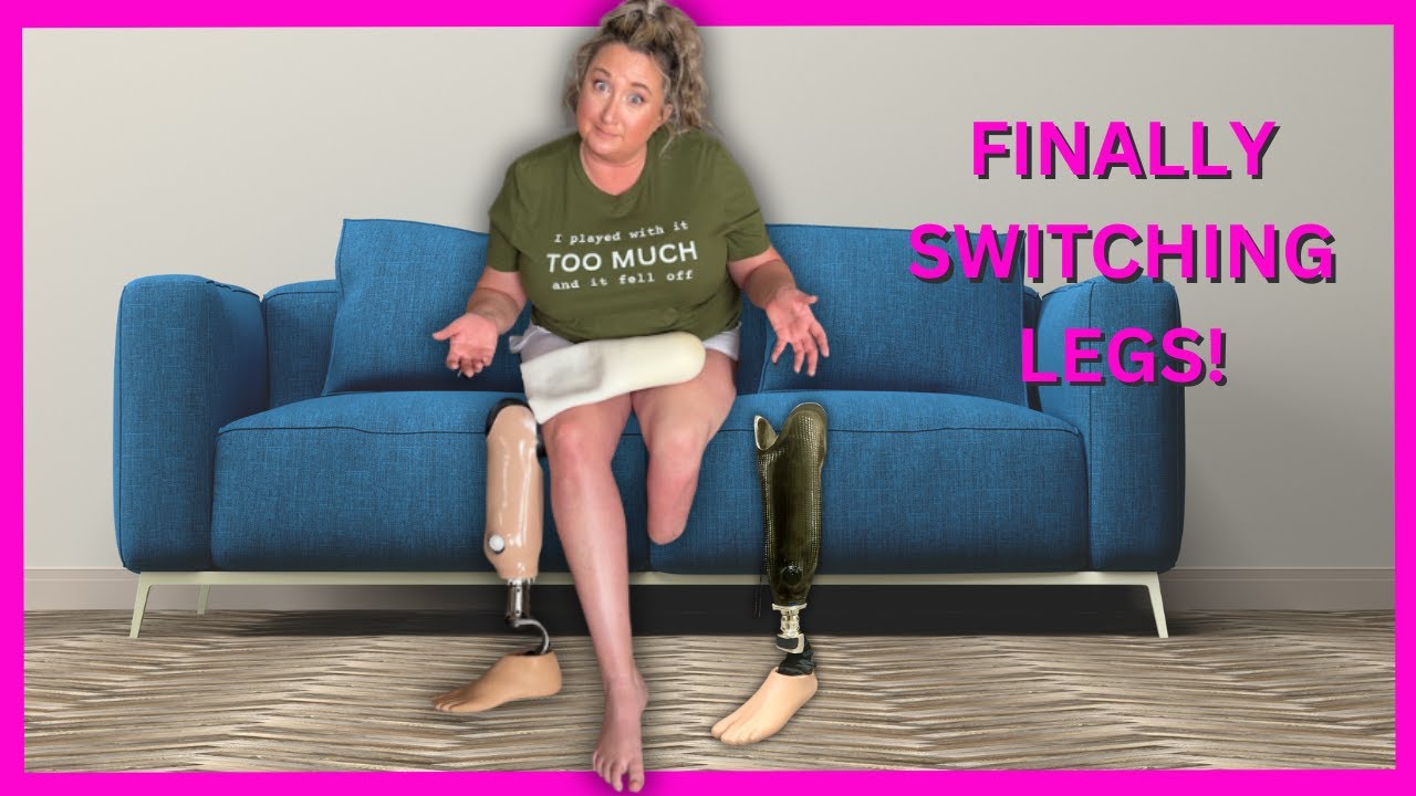 Below The Knee Amputee FINALLY switching to suspension sleeve socket!