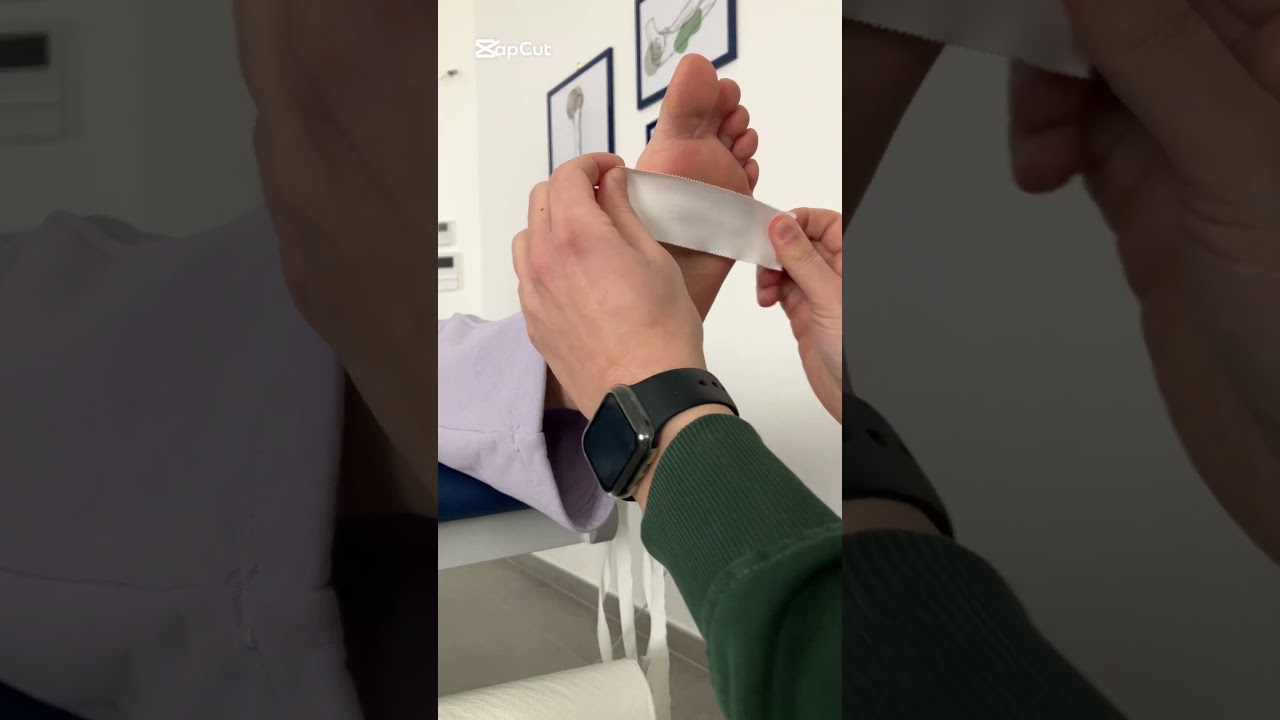 FASCITE PLANTARE: bendaggio per alleviare il dolore #shorts  #fisioterapia  #perte #massage