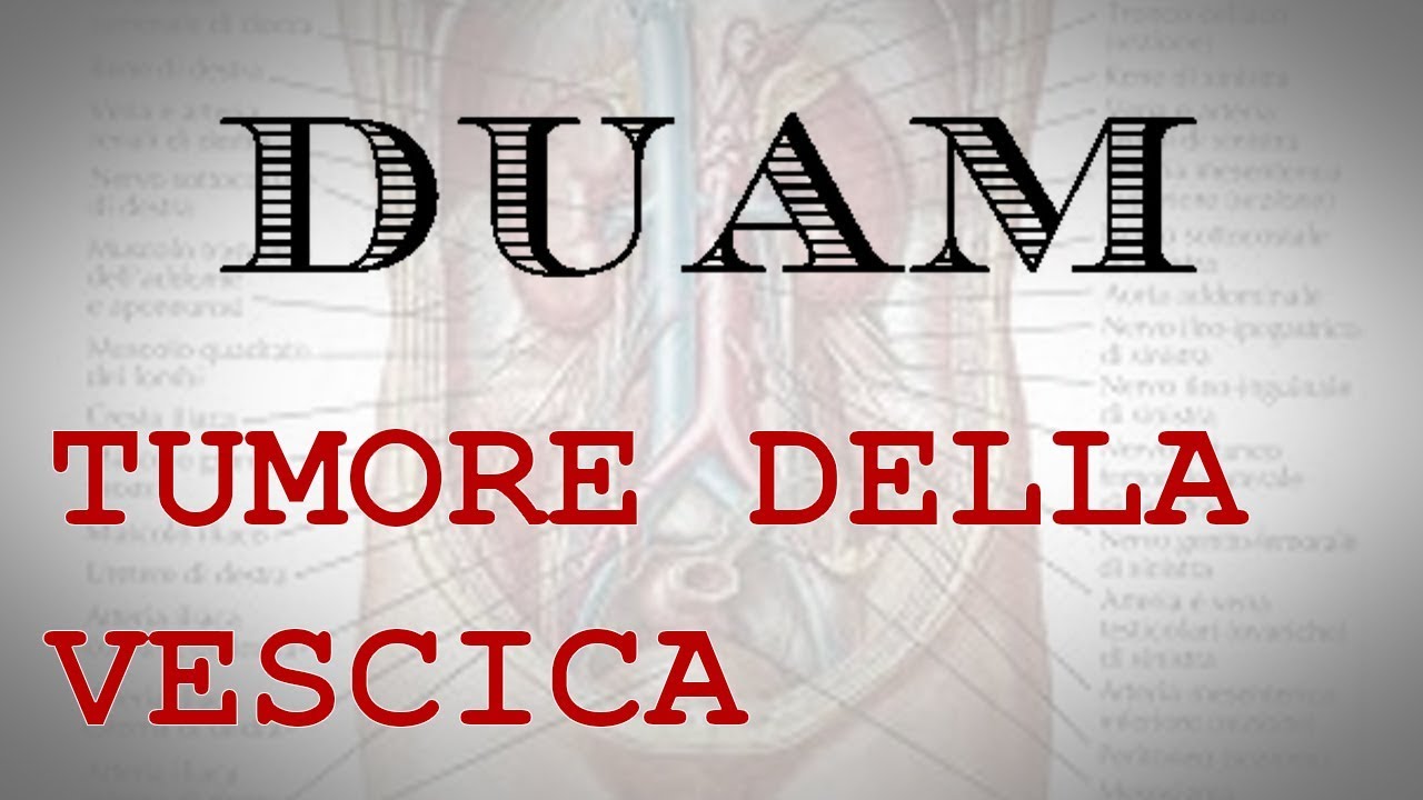 Tumore della vescica: La cistectomia radicale robotica
