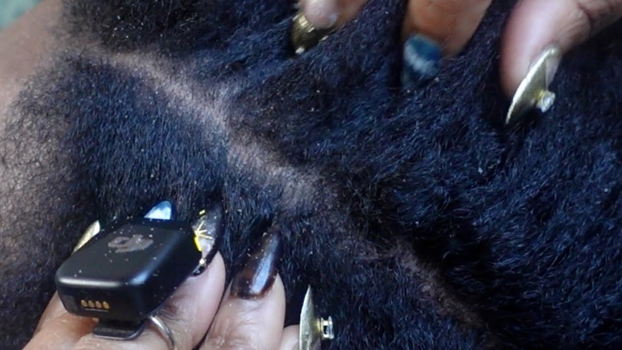 Super Tingly Scratching Sounds Flaky Scalp Scratching ASMR (no talking!)