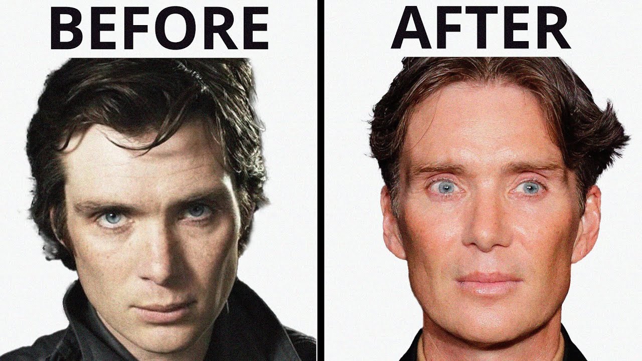 Cillian Murphy: All Natural? | Plastic Surgery Analysis