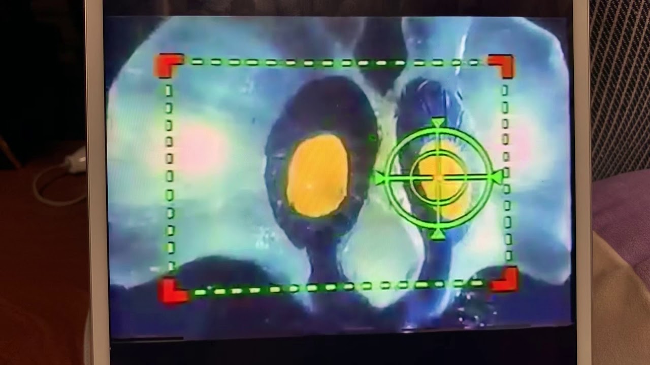 プロテ星人