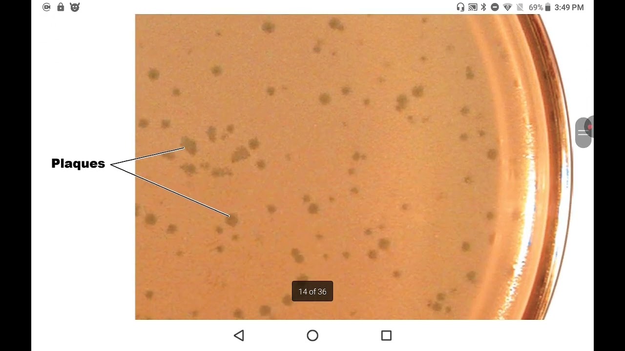 Microbiology | Unit 11 Viruses, Viriods and prions