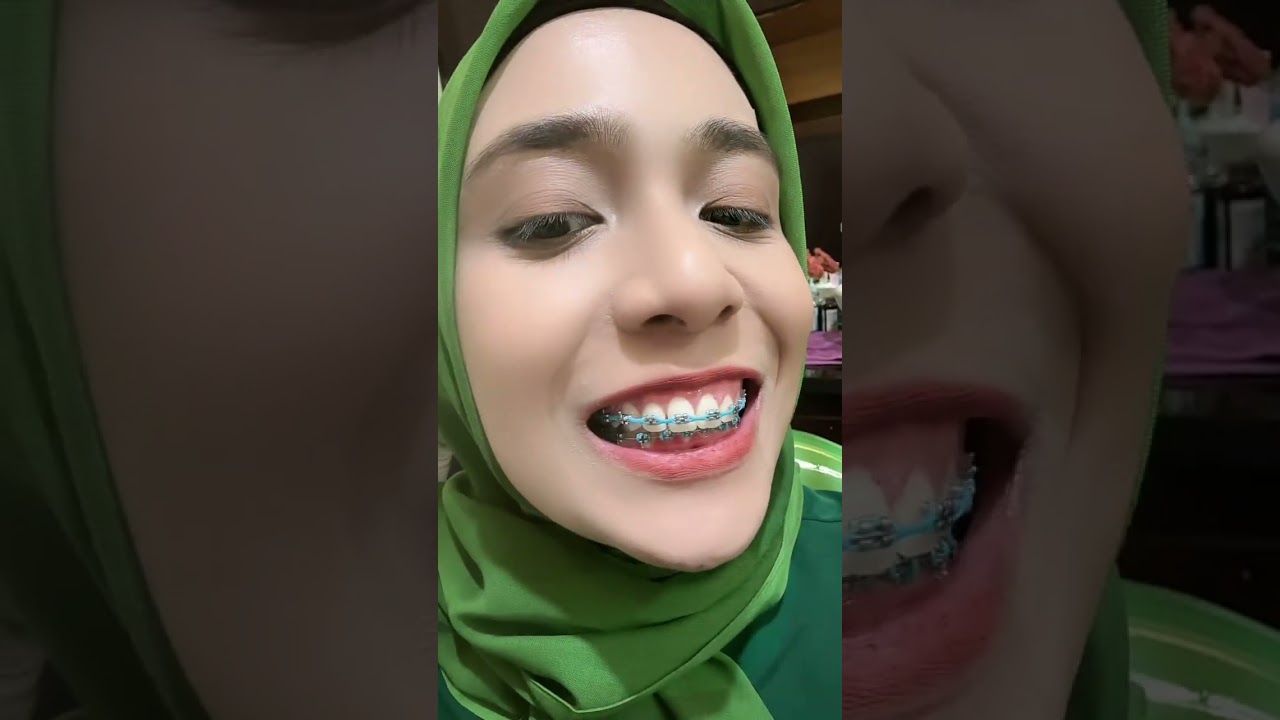 PERJALANAN SINGKAT AKU PAKE BEHEL SELAMA 1,3 TAHUN
