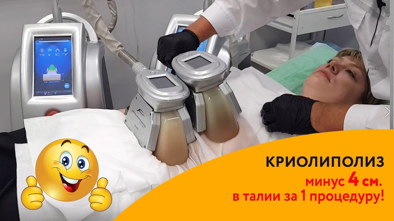 Криолиполиз - минус 4 см в талии за 1 процедуру. Худеем с Доктор Борменталь.