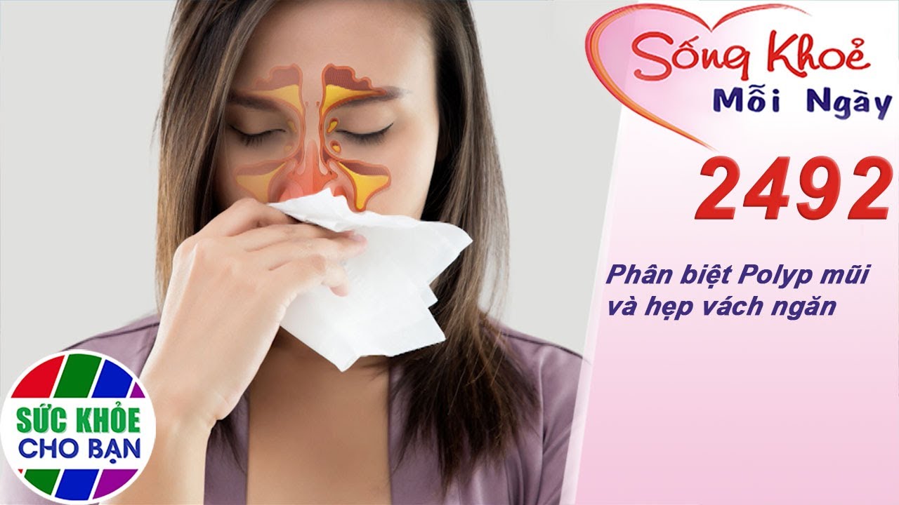 Phân biệt Polyp mũi và hẹp vách ngăn | Sống khỏe mỗi ngày – Kỳ 2492